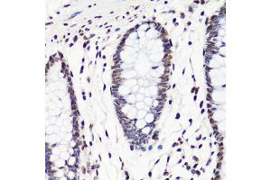 Immunohistochemistry (Paraffin-embedded Sections) (IHC (p)) image for anti-Histone 3 (H3) (H3K36me2) antibody (ABIN3016036)