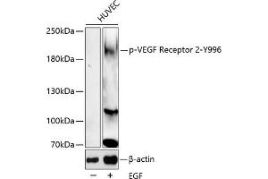 Western blot analysis of extracts of HUVEC cell line, using Phospho-VEGF Receptor 2-Y996 antibody (ABIN6135337, ABIN6136290, ABIN6136291 and ABIN6225613). (VEGFR2/CD309 抗体  (pTyr996))