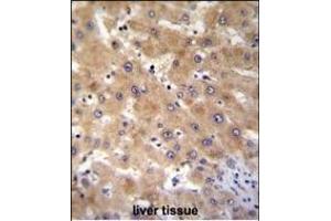 GAGE12B Antibody (N-term) (ABIN655201 and ABIN2844816) immunohistochemistry analysis in formalin fixed and paraffin embedded human liver tissue followed by peroxidase conjugation of the secondary antibody and DAB staining. (G Antigen 12B 抗体  (N-Term))