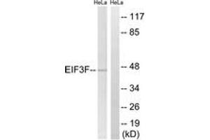 Western blot analysis of extracts from HeLa cells, using EIF3F Antibody. (EIF3F 抗体  (AA 81-130))