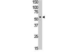 The SIGLEC7 polyclonal antibody  is used in Western blot to detect SIGLEC7 in Jurkat cell lysate. (SIGLEC7 抗体  (C-Term))