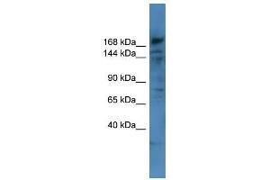Western Blot showing COL4A6 antibody used at a concentration of 1-2 ug/ml to detect its target protein. (COL4a6 抗体  (Middle Region))