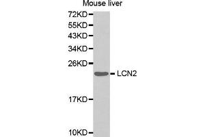 Western Blotting (WB) image for anti-Lipocalin 2 (LCN2) (AA 1-100) antibody (ABIN3017526) (Lipocalin 2 抗体  (AA 1-100))