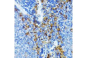 Immunohistochemistry of paraffin-embedded mouse spleen using J Rabbit mAb (ABIN7268036) at dilution of 1:100 (40x lens). (JAK1 抗体)
