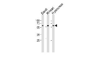 Western blot analysis of lysates from Daudi cell line, human heart and ncreas tissue lysate(from left to right), using CSIN1 Antibody (G23) (ABIN392664 and ABIN2842162). (PACSIN1 抗体  (N-Term))