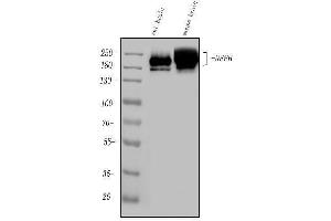 Western blot analysis of Nefh using anti-Nefh antibody (ABIN7599700).