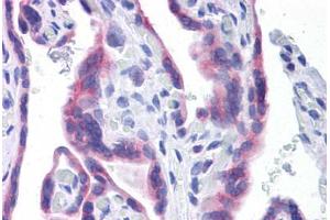 Immunohistochemistry (Formalin-fixed Paraffin-embedded Sections) (IHC (fp)) image for anti-STT3, Subunit of The Oligosaccharyltransferase Complex, Homolog A (STT3A) (AA 603-702) antibody (ABIN574288)
