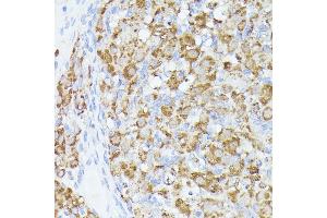 Immunohistochemistry of paraffin-embedded rat ovary using  antibody (ABIN6131166, ABIN6136417, ABIN6136418 and ABIN6223845) at dilution of 1:100 (40x lens). (ACAT2 抗体  (AA 1-97))