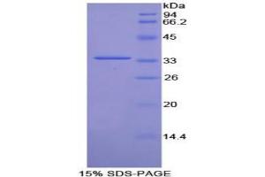 SDS-PAGE analysis of Rat Torsin 3A Protein. (TOR3A 蛋白)