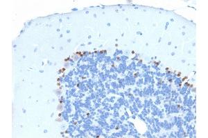 Immunohistochemistry (IHC) image for anti-SRY (Sex Determining Region Y)-Box 2 (SOX2) (AA 176-305) antibody (ABIN6940611)