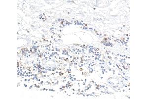 Immunohistochemistry (IHC) image for anti-CD96 (CD96) (AA 29-502) antibody (ABIN7455093) (Recombinant CD96 抗体  (AA 29-502))