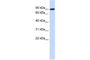 WB Suggested Anti-PGM2L1 Antibody Titration: 0. (PGM2L1 抗体  (N-Term))
