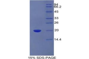 SDS-PAGE analysis of Human PROCR Protein. (PROCR 蛋白)