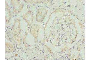 Immunohistochemistry of paraffin-embedded human kidney tissue using ABIN7172352 at dilution of 1:100 (TRAPPC1 抗体  (AA 1-260))