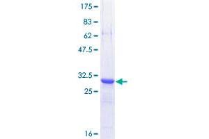 TFF3 Protein (AA 15-73) (GST tag)
