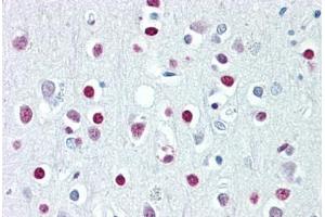 Anti-WHSC1 / NSD2 antibody IHC staining of human brain, cortex. (WHSC1 抗体  (AA 219-268))