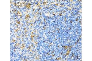 Immunohistochemistry of paraffin-embedded Mouse spleen using CD27 Polyclonal Antibody at dilution of 1:100 (40x lens). (CD27 抗体)