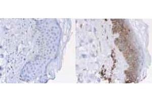 Immunohistochemistry of Rabbit anti-Beta-2-Microglobulin Antibody. (beta-2 Microglobulin 抗体  (HRP))