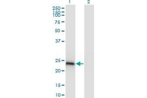 Western Blotting (WB) image for anti-Chromobox Homolog 1 (CBX1) (AA 2-99) antibody (ABIN524353)