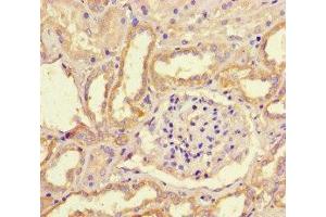 Immunohistochemistry of paraffin-embedded human kidney tissue using ABIN7169234 at dilution of 1:100 (WNK4 抗体  (AA 828-1106))