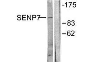Western blot analysis of extracts from HuvEc cells, using SENP7 Antibody. (SENP7 抗体  (AA 991-1040))