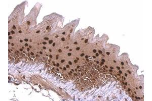 Immunohistochemistry (IHC) image for anti-Kruppel-Like Factor 4 (Gut) (KLF4) antibody (ABIN2855076)