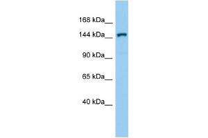 Host:  Rabbit  Target Name:  Corin  Sample Type:  Mouse Testis lysates  Antibody Dilution:  1.