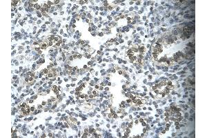 Human Lung; . (SUPT5H 抗体  (C-Term))