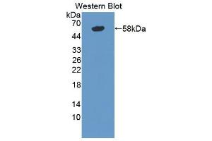 Western blot analysis of the recombinant protein. (TNXB 抗体  (AA 3835-4088))