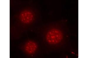 Immunofluorescence (IF) image for anti-Forkhead Box O4 (FOXO4) (pSer197) antibody (ABIN1870198) (FOXO4 抗体  (pSer197))