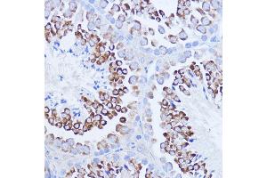 Immunohistochemistry (IHC) image for anti-Poly(A) Binding Protein, Cytoplasmic 1 (PABPC1) (AA 350-450) antibody (ABIN7269446)