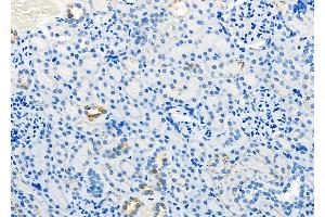 ABIN6260006 and ABIN6279136 at 1/100 staining Rat kidney tissue by IHC-P. (AQP11 抗体  (Internal Region))