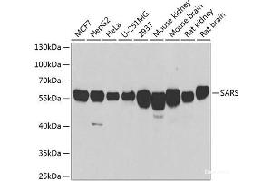 Western blot analysis of extracts of various cell lines using SARS Polyclonal Antibody at dilution of 1:1000. (Seryl-tRNA Synthetase (SARS) 抗体)