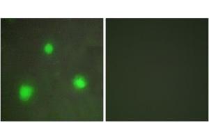 Immunofluorescence analysis of A549 cells, using FOXH1 antibody. (FOXH1 抗体  (N-Term))