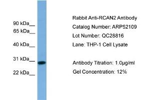 WB Suggested Anti-RCAN2  Antibody Titration: 0. (RCAN2 抗体  (Middle Region))