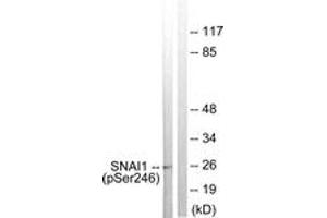 Western blot analysis of extracts from HT29 cells, using SNAI1 (Phospho-Ser246) Antibody. (SNAIL 抗体  (pSer246))