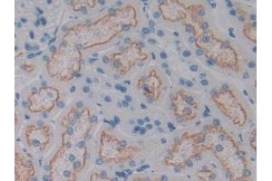 DAB staining on IHC-P; Samples: Rat Kidney Tissue (CD320 抗体  (AA 36-256))