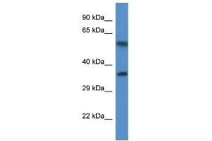 Western Blot showing MRPL45 antibody used at a concentration of 1. (MRPL45 抗体  (C-Term))