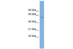 WB Suggested Anti-KIAA1430 Antibody Titration: 0. (CFAP97/KIAA1430 抗体  (Middle Region))