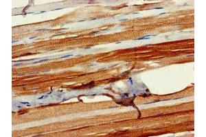 Immunohistochemistry of paraffin-embedded human skeletal muscle tissue using ABIN7162895 at dilution of 1:100 (PLIN4 抗体  (AA 308-418))