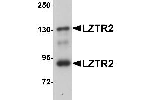 Western Blotting (WB) image for anti-SEC16 Homolog B (SEC16B) (C-Term) antibody (ABIN1030501) (SEC16B 抗体  (C-Term))