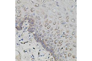 Immunohistochemistry of paraffin-embedded human esophagus using APP antibody. (beta Amyloid 抗体)