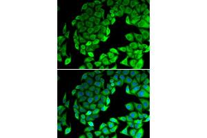 Immunofluorescence analysis of MCF-7 cells using RPL14 antibody (ABIN6291381). (RPL14 抗体)