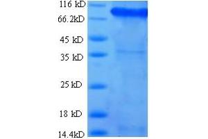 SDS-PAGE (SDS) image for Succinate Dehydrogenase Complex, Subunit A, Flavoprotein (Fp) (SDHA) (AA 44-664) protein (His-SUMO Tag) (ABIN4976180) (SDHA Protein (AA 44-664) (His-SUMO Tag))