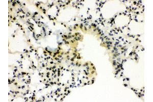 Immunohistochemistry (Paraffin-embedded Sections) (IHC (p)) image for anti-Sp3 Transcription Factor (Sp3) (AA 569-599), (C-Term) antibody (ABIN3043350) (Sp3 抗体  (C-Term))