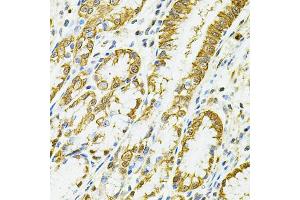 Immunohistochemistry of paraffin-embedded human esophagus using HLA-DQA1 antibody (ABIN5971195) at dilution of 1/100 (40x lens). (HLA-DQA1 抗体)