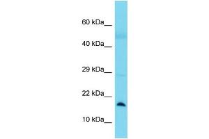 Host:  Rabbit  Target Name:  BLOC1S1  Sample Type:  Lung Tumor lysates  Antibody Dilution:  1. (BLOC1S1 抗体  (N-Term))