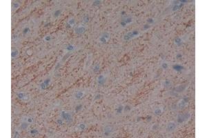 Detection of DBP in Human Cerebrum Tissue using Polyclonal Antibody to Vitamin D Binding Protein (DBP) (Vitamin D-Binding Protein 抗体  (AA 209-401))