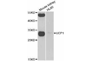 Western blot analysis of extracts of various cell lines, using UCP1 antibody (ABIN2560658) at 1:1000 dilution.