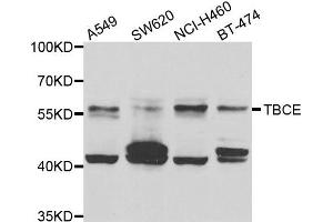 Western blot analysis of extracts of various cell lines, using TBCE antibody. (TBCE 抗体)